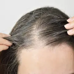 Nahaufnahme von Haaren mit grauen Strähnen. Die Frage "ab wann bekommt man graue Haare" beschäftigt viele.