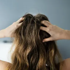 Hände kratzen am Kopf, Haare brechen am Ansatz ab. Was tun bei Haarbruch?