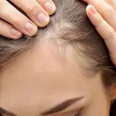 Feine Babyhaare an der Stirn einer Frau, die sich besorgt die Haare zurückstreicht.