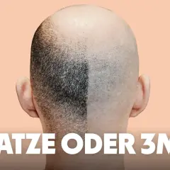 Vergleich: Eine Kopfhälfte mit kurzem Haar (3mm Buzz Cut), die andere glatt rasiert.