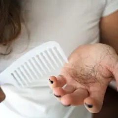 Frau hält Haarkamm und eine Handvoll Haare, die auf extremer Haarausfall nach Schwangerschaft hindeuten.