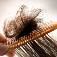 Eine Hand hält einen Kamm, der durch stark verfilzte Haare fährt. Ein trauriger Anblick von Haarausfall.
