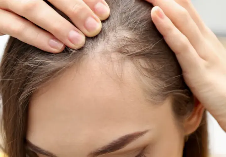 Feine Babyhaare an der Stirn einer Frau, die sich besorgt die Haare zurückstreicht.