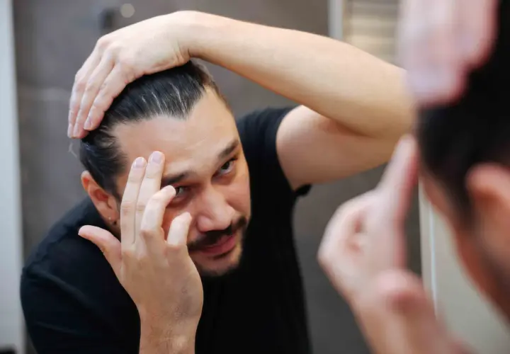 Mann prüft seine Haare im Spiegel. Er überlegt, ob Aminexil oder Minoxidil besser gegen Haarausfall hilft.