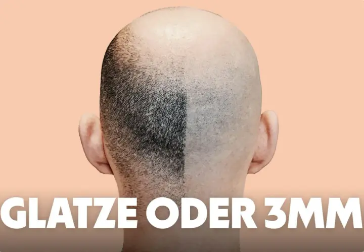Vergleich: Eine Kopfhälfte mit kurzem Haar (3mm Buzz Cut), die andere glatt rasiert.