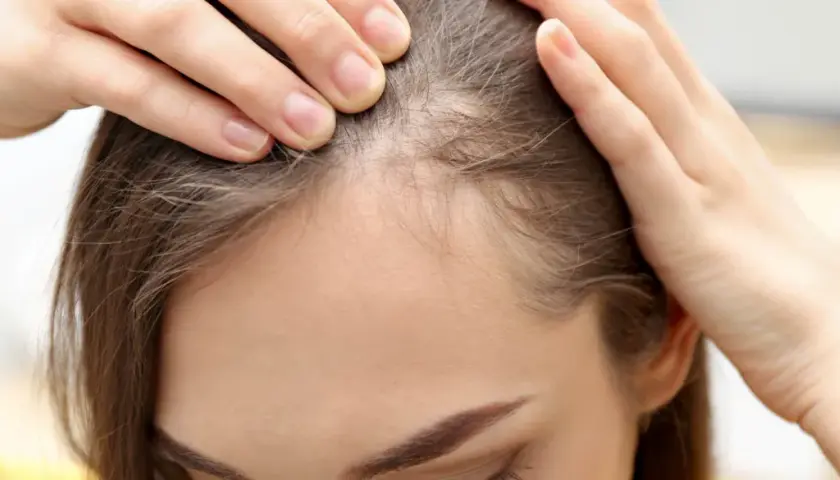 Feine Babyhaare an der Stirn einer Frau, die sich besorgt die Haare zurückstreicht.