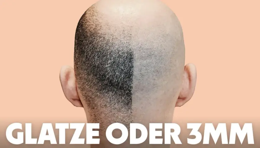 Vergleich: Eine Kopfhälfte mit kurzem Haar (3mm Buzz Cut), die andere glatt rasiert.