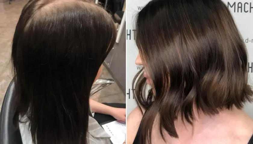 Vorher-Nachher-Vergleich: Dunkles Haar wird aufgehellt und zu einem Bob geschnitten. Die Haarfarbe entfernen war erfolgreich.