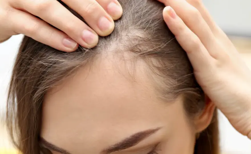 Feine Härchen am Haaransatz - Babyhaare richtig pflegen & stylen