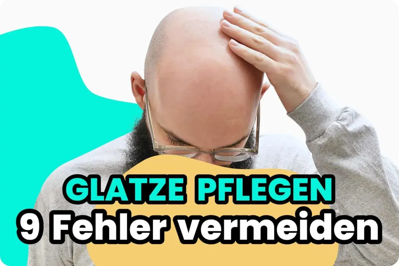 Mann mit Glatze und Brille berührt seine Stirn. Text: "Glatze pflegen - 9 Fehler vermeiden". Keine Schuppen sichtbar.