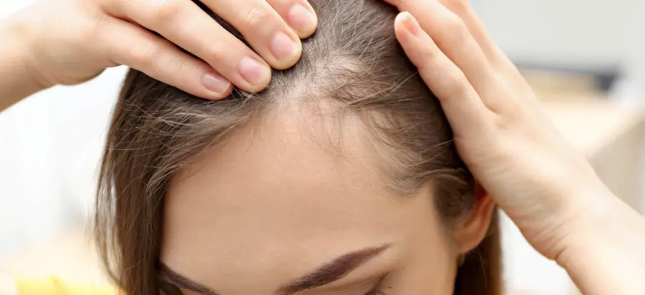 Feine Babyhaare an der Stirn einer Frau, die sich besorgt die Haare zurückstreicht.