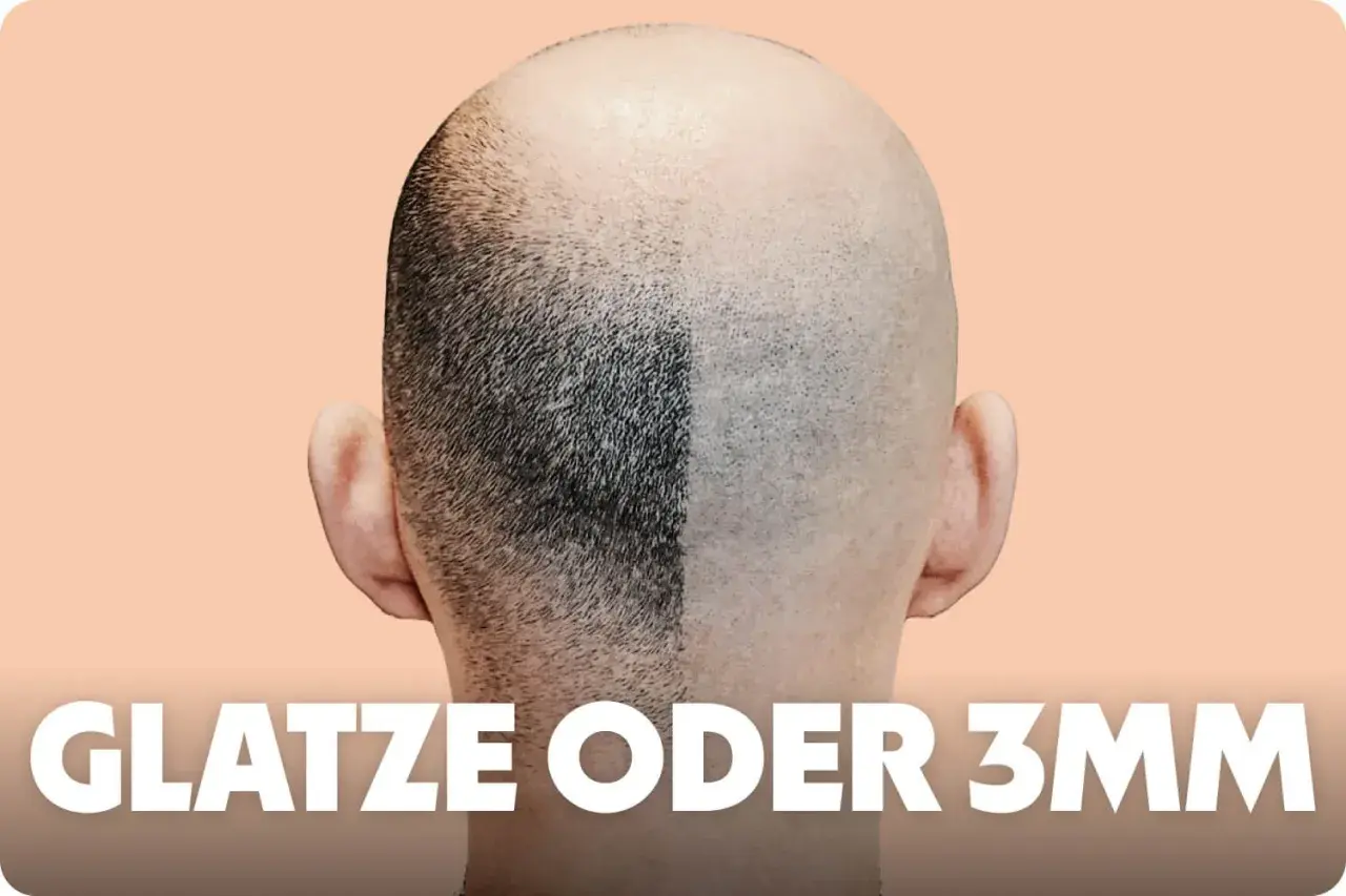 Vergleich: Eine Kopfhälfte mit kurzem Haar (3mm Buzz Cut), die andere glatt rasiert.