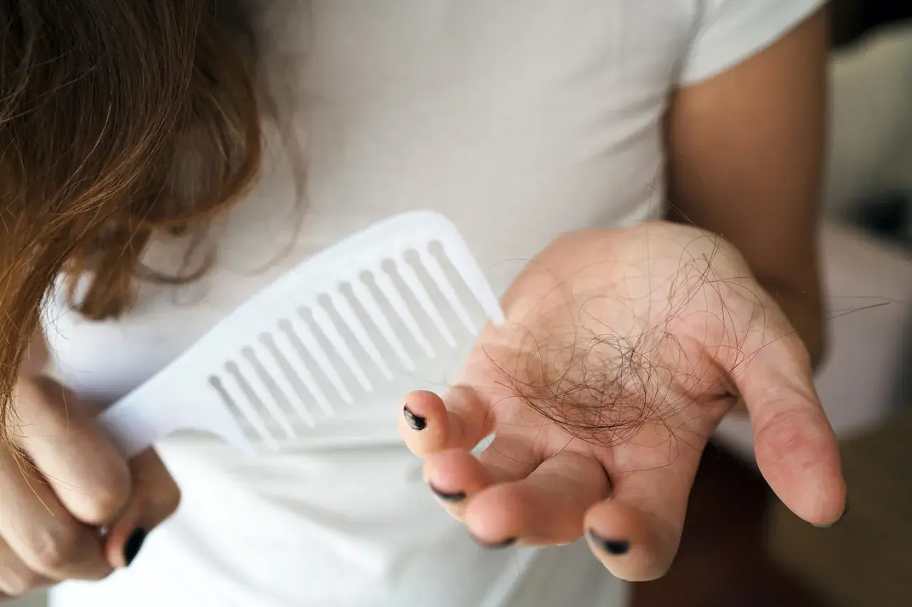 Frau hält Haarkamm und eine Handvoll Haare, die auf extremer Haarausfall nach Schwangerschaft hindeuten.