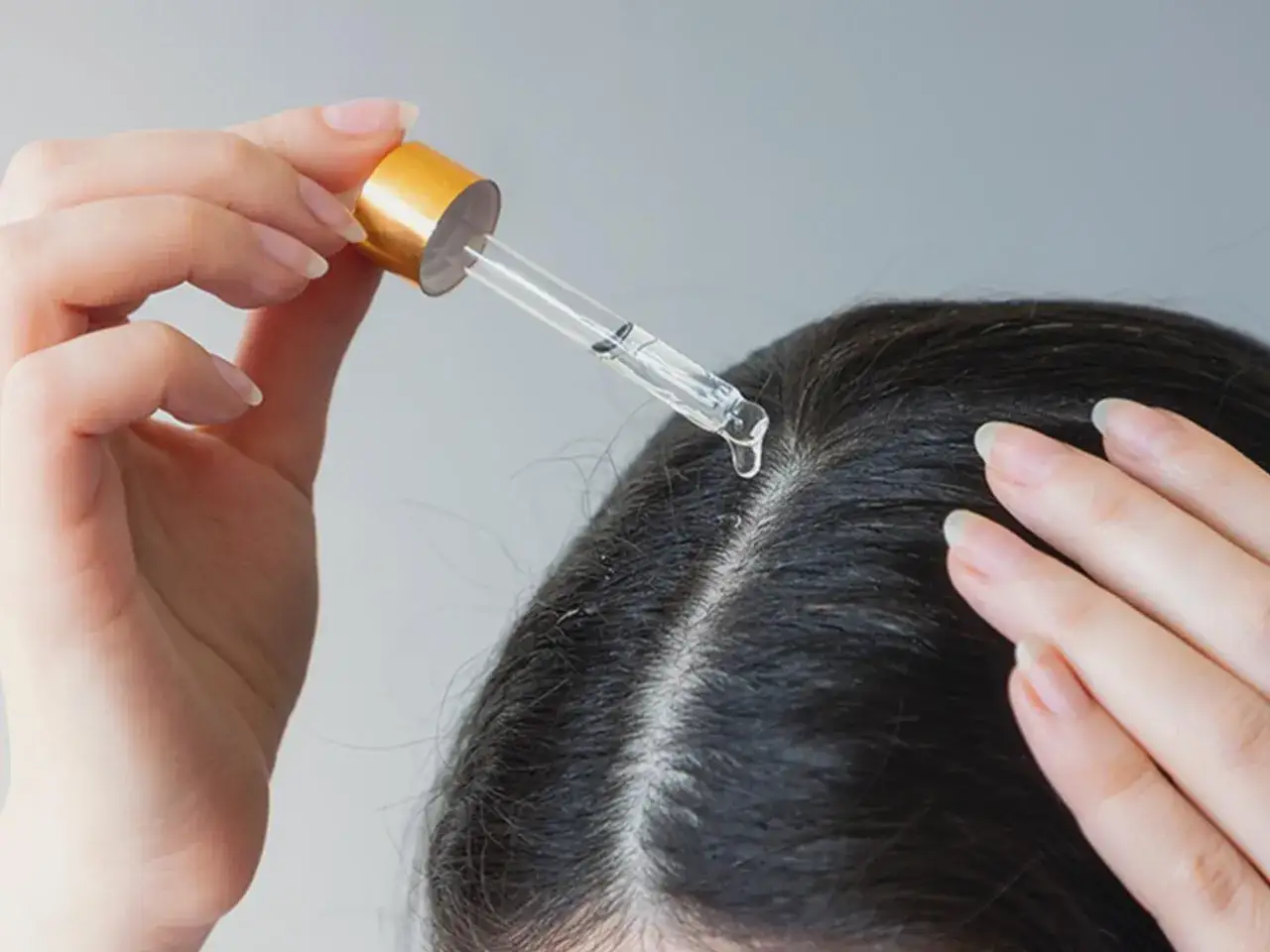 Eine Hand trägt mit einer Pipette ein Serum auf die Kopfhaut auf, um fettige Schuppen zu bekämpfen.