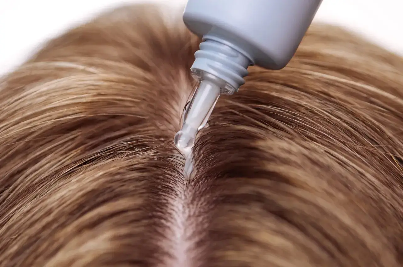 Tropfen eines Serums fallen auf die Kopfhaut, um Haare schneller wachsen lassen zu fördern.